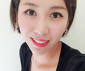全隐形矫正