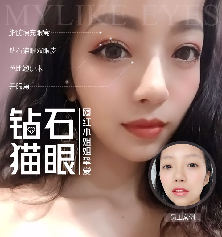 钻石猫眼