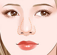 原生佳人弧线鼻