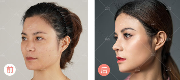 美莱生态美鼻