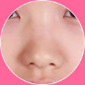 塌鼻子
