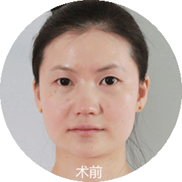 美莱生态美鼻