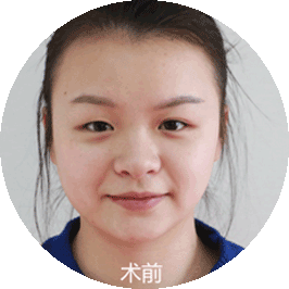 原生佳人弧线鼻