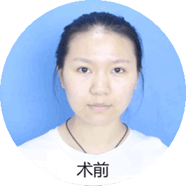 3分钟极塑美鼻