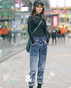 术后第50天