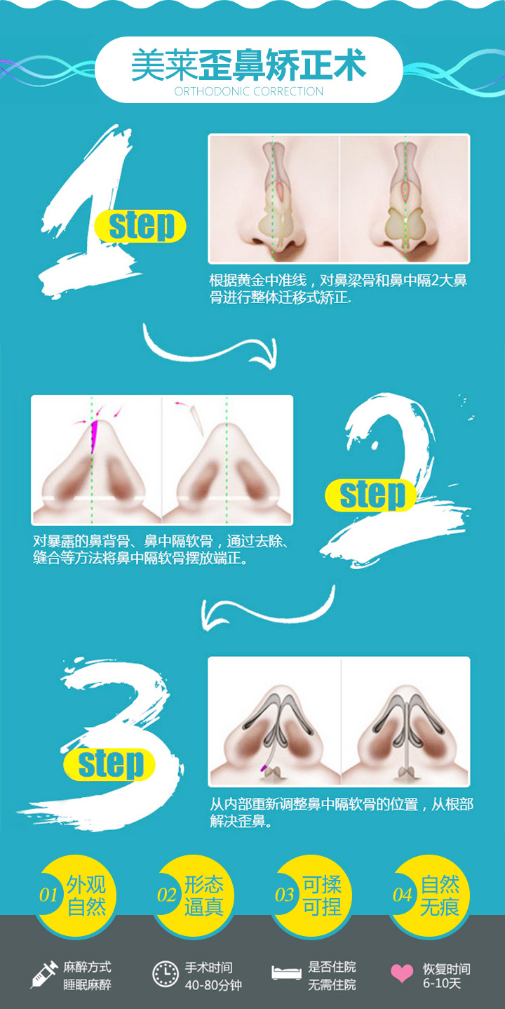 美莱歪鼻矫正术