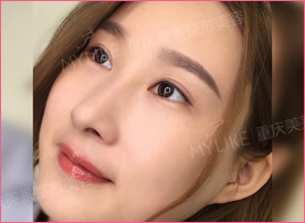 美莱纹唇步骤