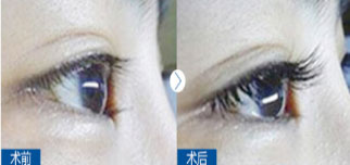 美莱纹绣——纹眼线