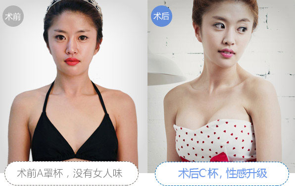 好莱坞维密动感丰胸对比图 