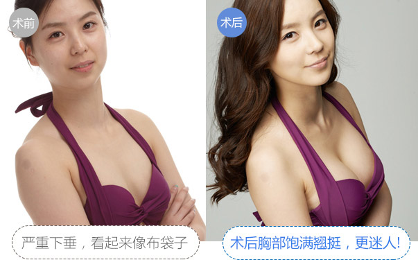 好莱坞维密复合定制美胸对比图
