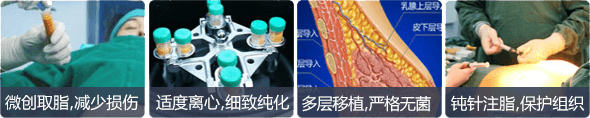 美莱自体脂肪丰胸优势
