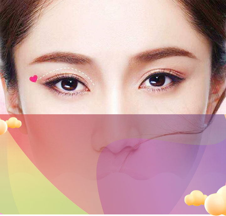 双眼皮修复重组